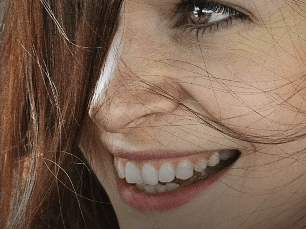 Sorriso bonito é o conjunto, não só dente branco